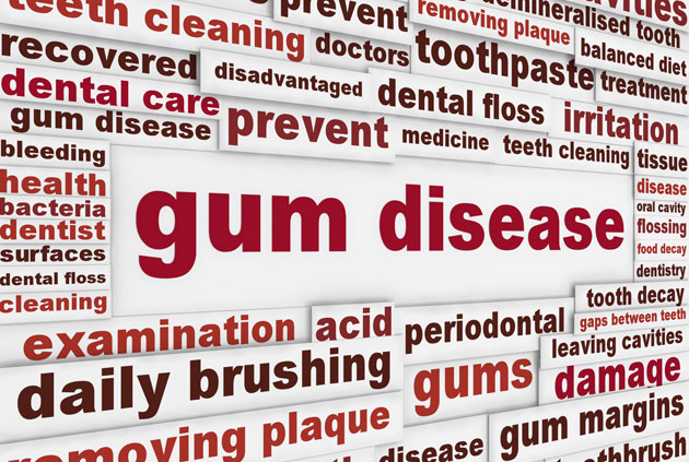 Gum Diseases