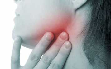 Head-and-Neck-Cancer