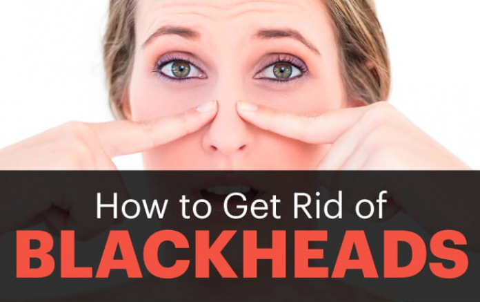 How to Get Rid of Blackheads